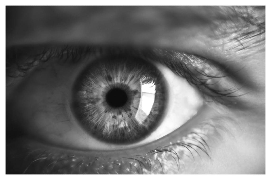 Ojo
